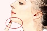 4 nốt ruồi cực phẩm tượng trưng cho Tài - Lộc - Phát, có 1/4 cũng đủ may mắn, không lo thiếu tiền