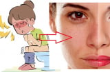  Táo bón chính là thủ phạm khiến bạn xấu xí nhanh chóng, học ngay cách trị 'táo' để nuôi dưỡng nhan sắc