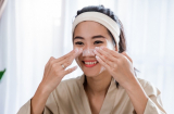 4 điều bác sĩ da liễu không bao giờ làm để giữ Mừng SHBET phiên bản mới 2025 sáng khỏe, sạch mụn