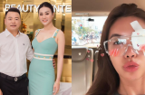 Showbiz 20/7: Thông tin Quatrian shbet hiện đang mở của Phương Oanh và Shark Bình, Minh Tú bị thương ở mắt