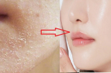 Thủ ngay bí kíp xử lý triệt để da bong tróc những lúc giao mùa