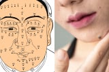 6 nốt ruồi tài lộc quý hơn vàng, mang phú quý cho cả nam và nữ