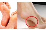 Thầy tướng số chỉ: Nhìn xuống chân thấy 5 điều này, bạn thuộc quý tướng cả đời không hết tiền, chuẩn hơn nhìn mặt