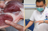 Phần thịt lợn chứa đầy mầm bệnh mà nhiều người Việt cực thích, phiên chợ nào cũng mua
