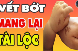 Phật Tổ đánh dấu: Ai có '4 loại bớt' này hưởng phúc 3 đời, không bon chen cũng có lộc