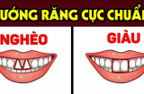 Nhìn tướng răng cửa biết ngay tương lai giàu sang hay nghèo khó: Chính xác hơn nhìn mặt
