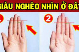 Đàn ông hay phụ nữ có 1 trong 4 dấu hiệu này ở ngón áp út, cuộc đời giàu sang sung túc hơn người