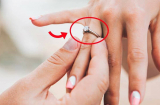 Thầy tướng số nói: Ngón áp út có 1 trong 4 dấu hiệu này, cuộc đời giàu sang sung túc hơn người