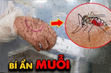 Mặc quần áo màu gì để muỗi tránh xa, không sợ bị đốt?