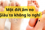 Dù nam hay nữ, có nốt ruồi ở vị trí này trên thân thì một đời ấm no, phúc khí dồi dào, xem ngay