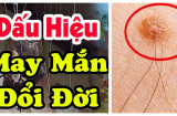 Người nghiệp ít, phúc nhiều thường có 3 vị trì này nhiều lông: Vị trí thứ 2 nhiều người tự ti nhưng cực tốt