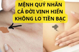 10 vết bớt đánh dấu mệnh Sh88bet link truy cập World Cup, tiền kiếp thiện lương kiếp này hưởng phúc, có 1 bớt là cả đời vinh hiển