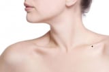 5 nốt ruồi may mắn, ai sở hữu thì vạn sự hanh thông, đắc tài đắc lộc: Nhìn xem bạn có không?