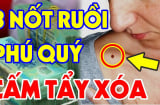 5 nốt ruồi 'trời sinh phúc khí', cái số 1 ai có ăn may hết phần thiên hạ