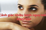 Đừng chủ quan, thâm quầng mắt có thể là dấu hiệu của những bệnh nguy hiểm này chứ không phải thiếu ngủ, khám ngay