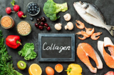 6 món là “mỏ collagen”, chị em ăn vào da đẹp mịn màng, lại giúp giữ dáng