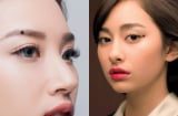9 nốt ruồi may mắn, phú quý, cả đời sung túc tiền tiêu không hết