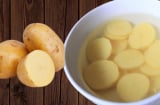 Tại sao ông bà ta dạy phải ngâm khoai tây trước khi chế biến?Lý do cực quan trọng, không nhớ có ngày gặp họa