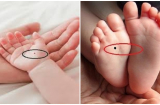 Trẻ có 1 trong 4 nốt ruồi ở vị trí này được Thần Phật che chở cả đời may mắn, sống trong nhung lụa