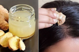 5 mẹo giải quyết tình trạng gàu rụng như tuyết, da đầu sạch và tóc giảm rụng đáng kể