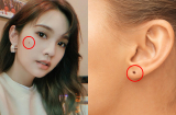 6 nốt ruồi Thần Tài, người có 1/6 không giàu nứt vách cũng phú quý ngập nhà