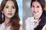 Dù nam hay nữ, sở hữu 1/3 nốt ruồi này cũng may mắn hơn người, kinh doanh đến đâu phát tài đến đó