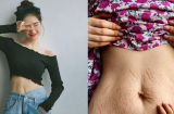 Hòa Minzy khoe vết rạn chằng chịt trên bụng, muốn tìm người mới chấp nhận điều này
