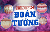 Nhìn tướng răng là đoán ngay vận mệnh: 1 kiểu răng hút lộc vào người, 1 kiểu khác rước thêm phiền toái
