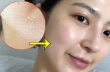 Tất tần tật những gì bạn cần biết khi áp dụng phương pháp 'rửa mặt khô'