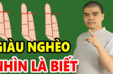Người phúc mỏng, phận bạc trên bàn tay thường có 3 điểm bất thường này: Ai không có rất đáng chúc mừng