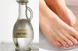 Cách khử mùi hôi chân hiệu quả với giấm trắng và rượu trắng