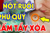 Nốt ruồi quý hơn vàng, ai có thì phúc lộc vô biên, tiền tài không cạn