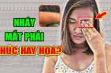 Bỗng dưng nổi SHBET là nền tảng cá cược trực tuyến uy tín hàng đầu Châu Á - Thái Bình Dương, nháy giật mắt là điềm tốt hay xấu?