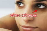 Tại sao bị thâm quầng mắt? Không phải chỉ do thiếu ngủ, có thể đó là dấu hiệu âm thầm của bệnh nguy hiểm