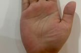 Giải mã ý nghĩa vân tay chữ M: Nét tướng quý hiếm mang đến tài lộc và vận may
