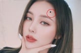 5 nốt ruồi phú quý của người mang số mệnh giàu sang, nốt ruồi càng sẫm màu, Shbet16 chơi game trực tuyến càng thịnh vượng