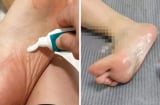 Tác dụng tuyệt vời của việc bôi kem đánh răng vào lòng bàn chân, cả nam và nữ đều hưởng lợi