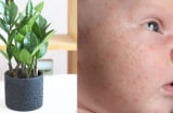 5 loại cây cảnh được trồng rất phổ biến trong nhà, nhưng lại có độc