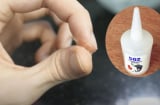 Tay bị dính keo 502, nhỏ ngay vài giọt này vào tay rồi xoa nhẹ là keo bong ra
