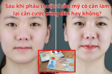 Sau khi Shbet888 tiền thưởng cực khủng thẩm mỹ có cần làm lại căn cước công dân hay không? Rất nhiều người không biết