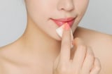 4 mẹo cơ bản giúp môi thâm mấy cũng trở nên hồng hào