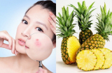 Loại trái cây rẻ tiền quen thuộc có vô vàn lợi ích làm đẹp nàng nên biết
