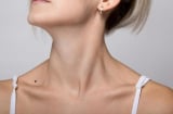 Giải mã ý nghĩa nốt ruồi ở cổ: Dấu hiệu may mắn hay xui xẻo