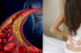 Người gầy vẫn bị mỡ máu cao vì những lý do này