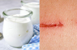 Nghiên cứu mới: Làm Gel trị thương từ sữa chua