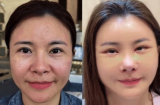Kim Oanh lên tiếng sau khi gây tranh cãi vì Shbet888 tiền thưởng cực khủng thẩm mỹ cả gương mặt