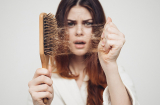 3 mẹo chăm sóc tóc mùa hanh khô, chống khô xơ và gãy rụng