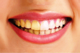 6 loại thực phẩm quen thuộc nhiều người thích mê khiến răng ố vàng dù đánh răng đều đặn mỗi ngày