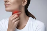 Tại sao các triệu chứng cảm lạnh thường bắt đầu từ cổ họng? Làm thế nào để giảm bớt sự khó chịu này?