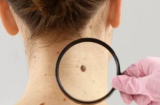 3 dấu hiệu “đen” trên Sh88bet đăng ký miễn phí cảnh báo ung thư cận kề: Tuyệt đối đừng chủ quan kẻo quá muộn!